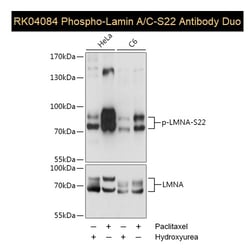 Phosphorylated lamin A/C antibody