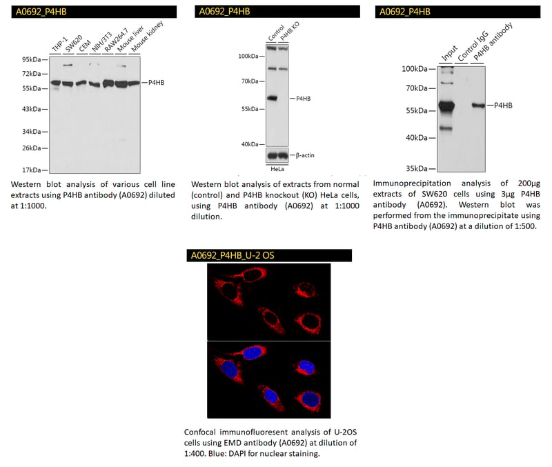 A0692 Knockout validated P4HB antibody