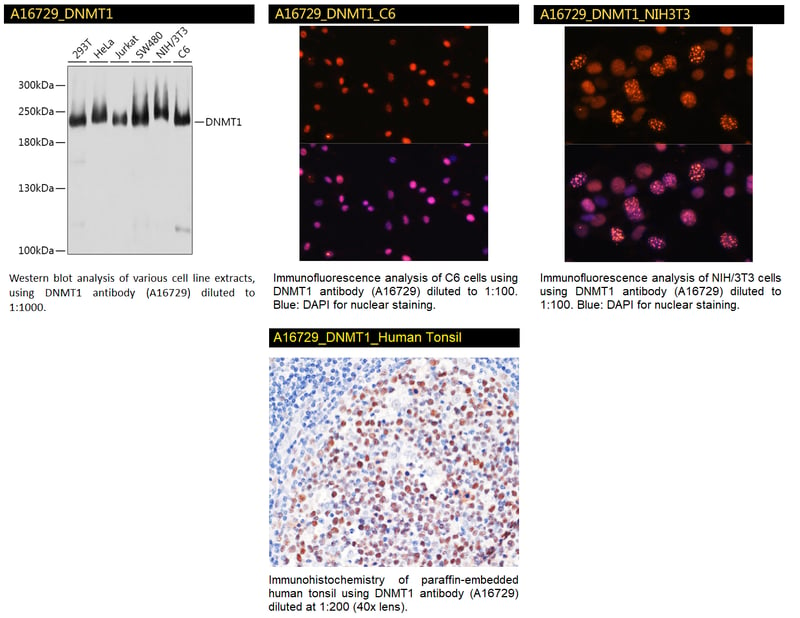 A16729 DNMT1 Antibody