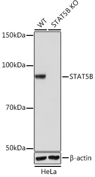 Knockout validation of STAT5B antibody