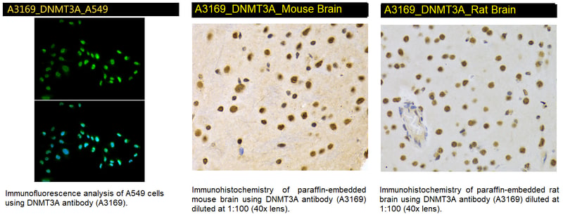 A3169 DNMTA3A Antibody