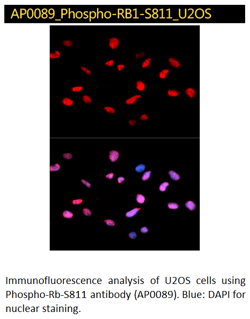 Phospho Rb Immunofluorescence