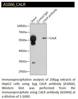 CALR antibody 2
