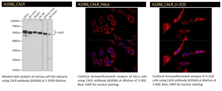 CALR antibody