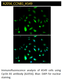 Cyclin B1 immunofluorescence