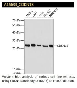 CDKN1B Polyclonal Antibody