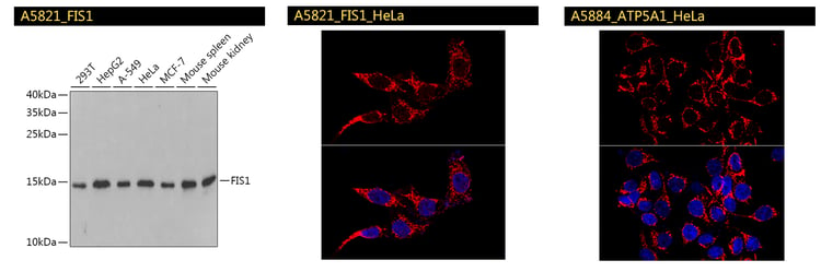 FIS1 ATP5A1