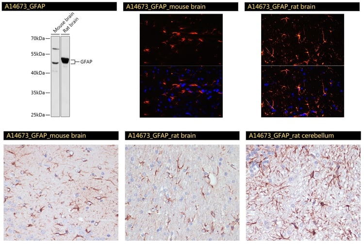 GFAP Antibody