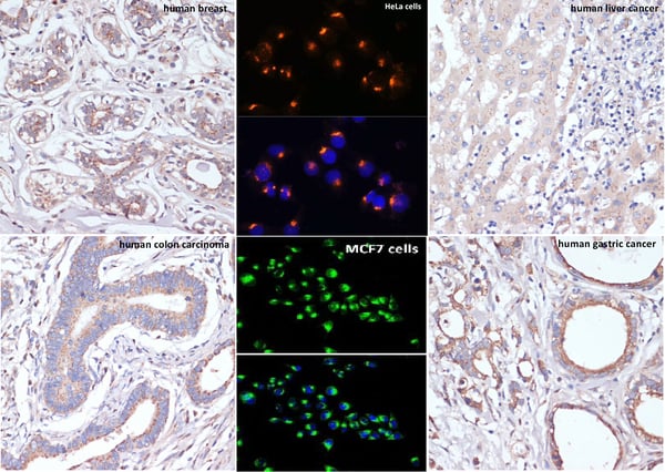 GOLM1 Antibody