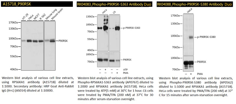 P90RSK Antibody