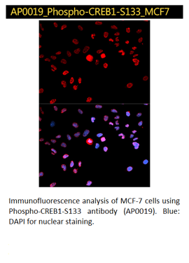 Pho-CREB1-S133 Antibody
