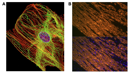 Immunofluorescence of actin cytoskeleton