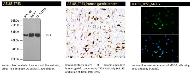 TP53 Polyclonal Antibody