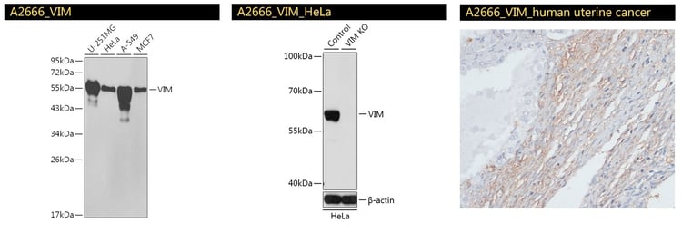 VIM Antibody