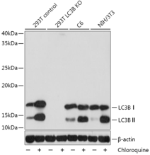 5 Notes For Autophagy Detection With LC3