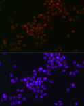 c-Myc immunofluorescence