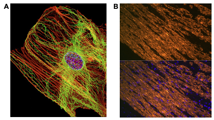 Visualization of actin cytoskeleton