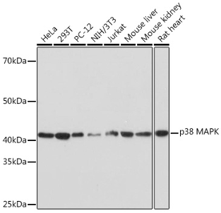 Figure x: Western blot analysis using p38 MAPK rabbit mAb (A4771)