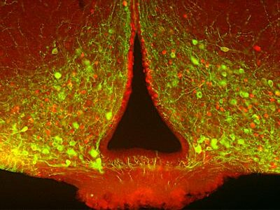 melanocortin neurons